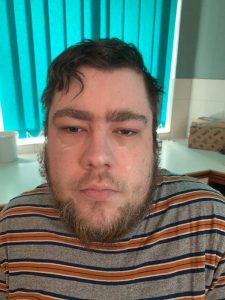 A tall bearded man that has some white cream all over his face wearing a grey striped t-shirt sat in a wooden dining chair.