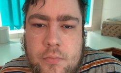 A tall bearded man that has some white cream all over his face wearing a grey striped t-shirt sat in a wooden dining chair.