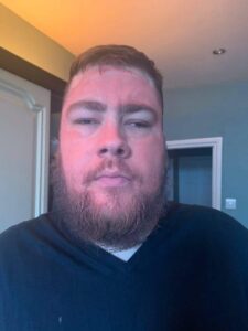 A tall bearded man that has some bright orange liquid all over his face wearing a light grey v-neck t-shirt stood against a white door.
